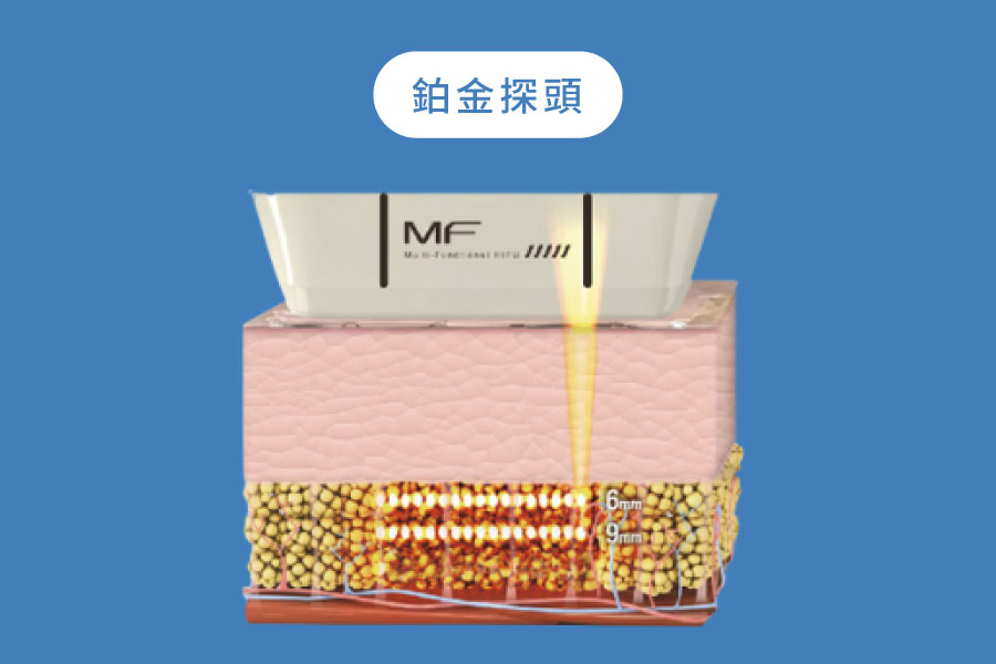 廣域聚焦額外示意